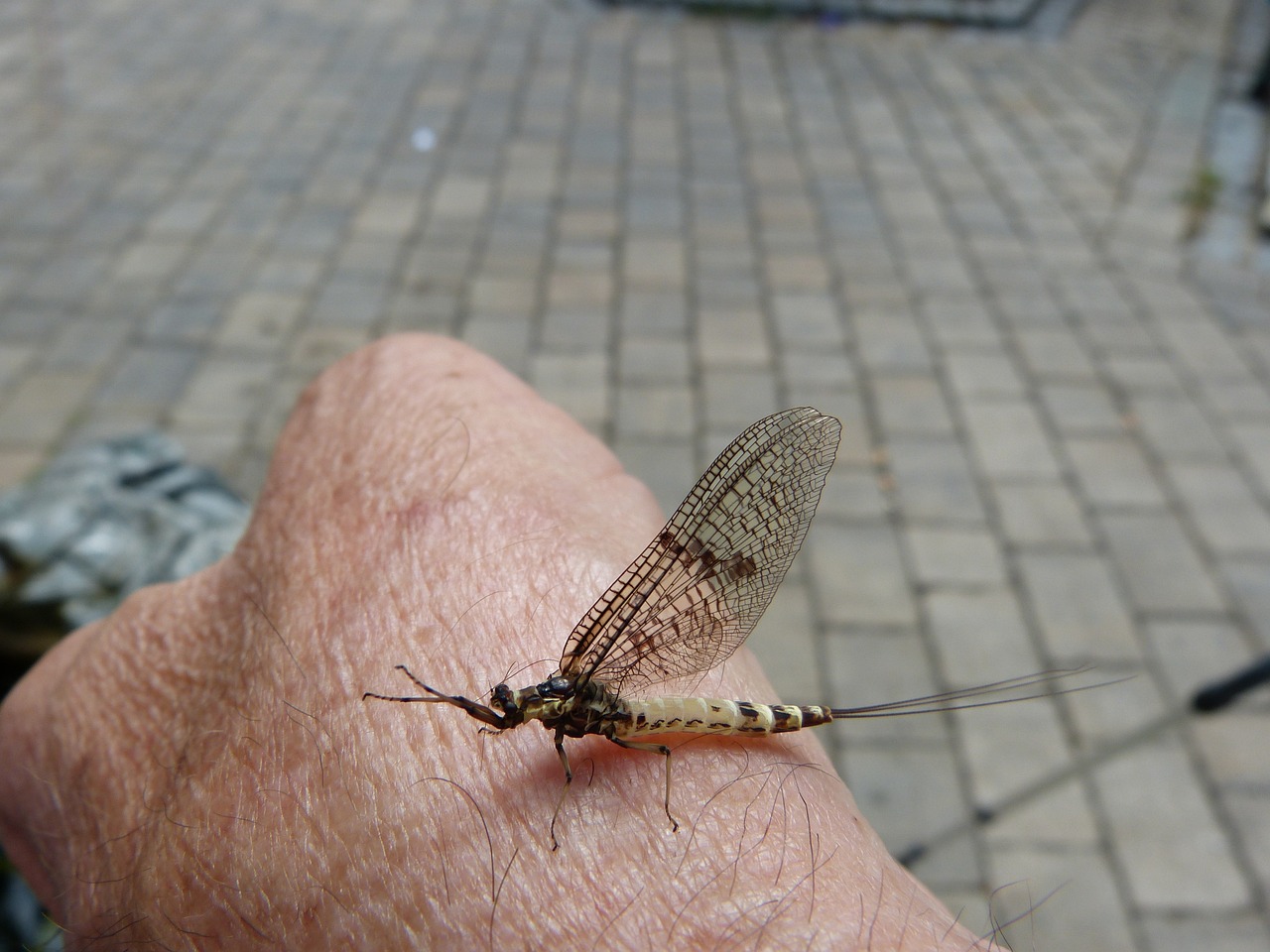 복부 탄력 시술